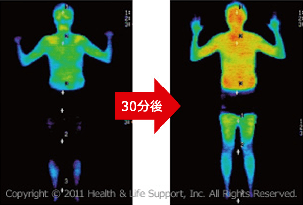 体表面の皮膚温度の上昇
